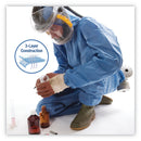 KleenGuard A60 Blood and Chemical Splash Protection Coveralls, 2X-Large, Blue, 24/Carton